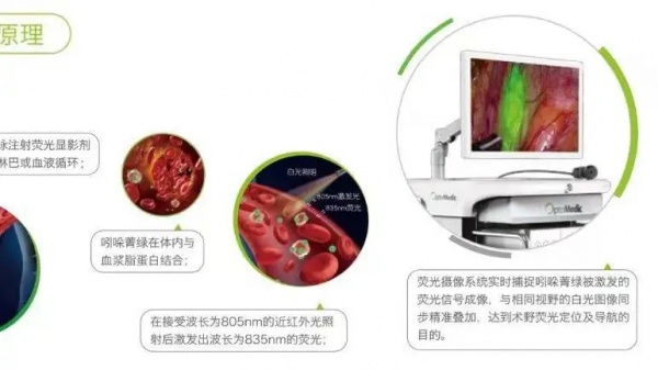 4K荧光ICG复合光源红外780nm+白光LED光源模组