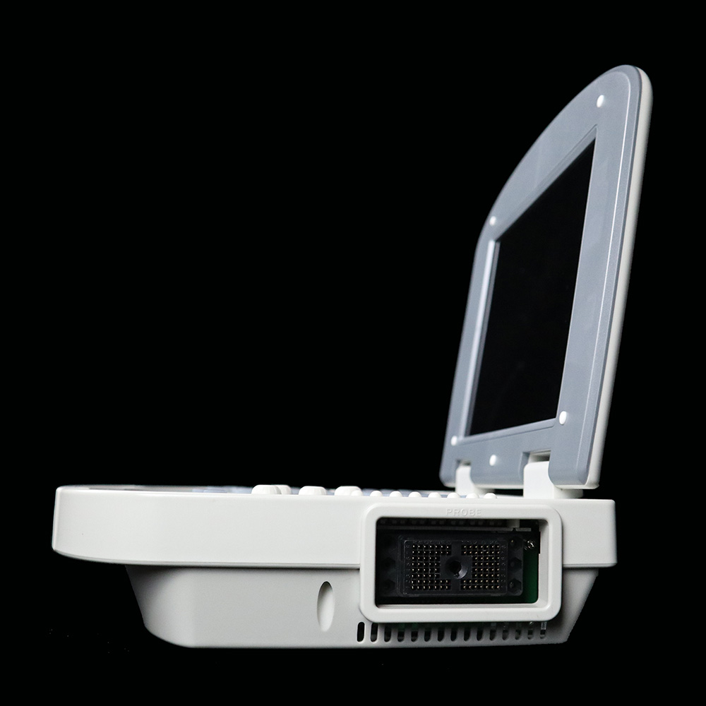 MDK-860笔记本式全数字黑白便携超声诊断仪